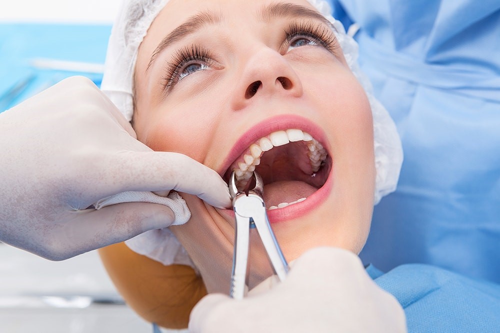 Tooth Extraction Reasons Procedure Before And After