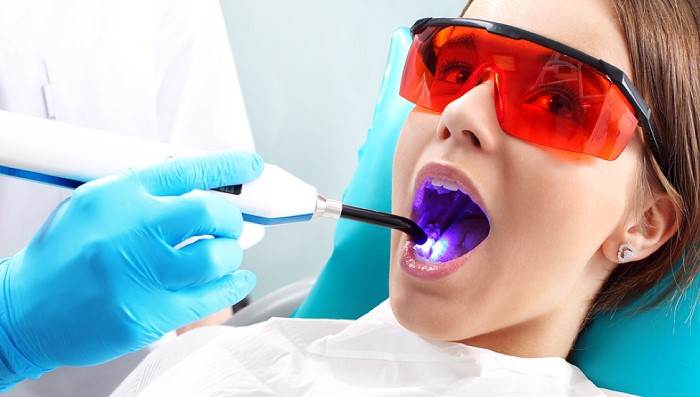 Tooth removal with laser: Advantages and procedure - missionimplantcenter
