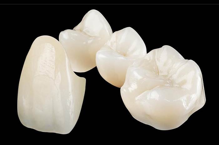 What are ceramic crowns