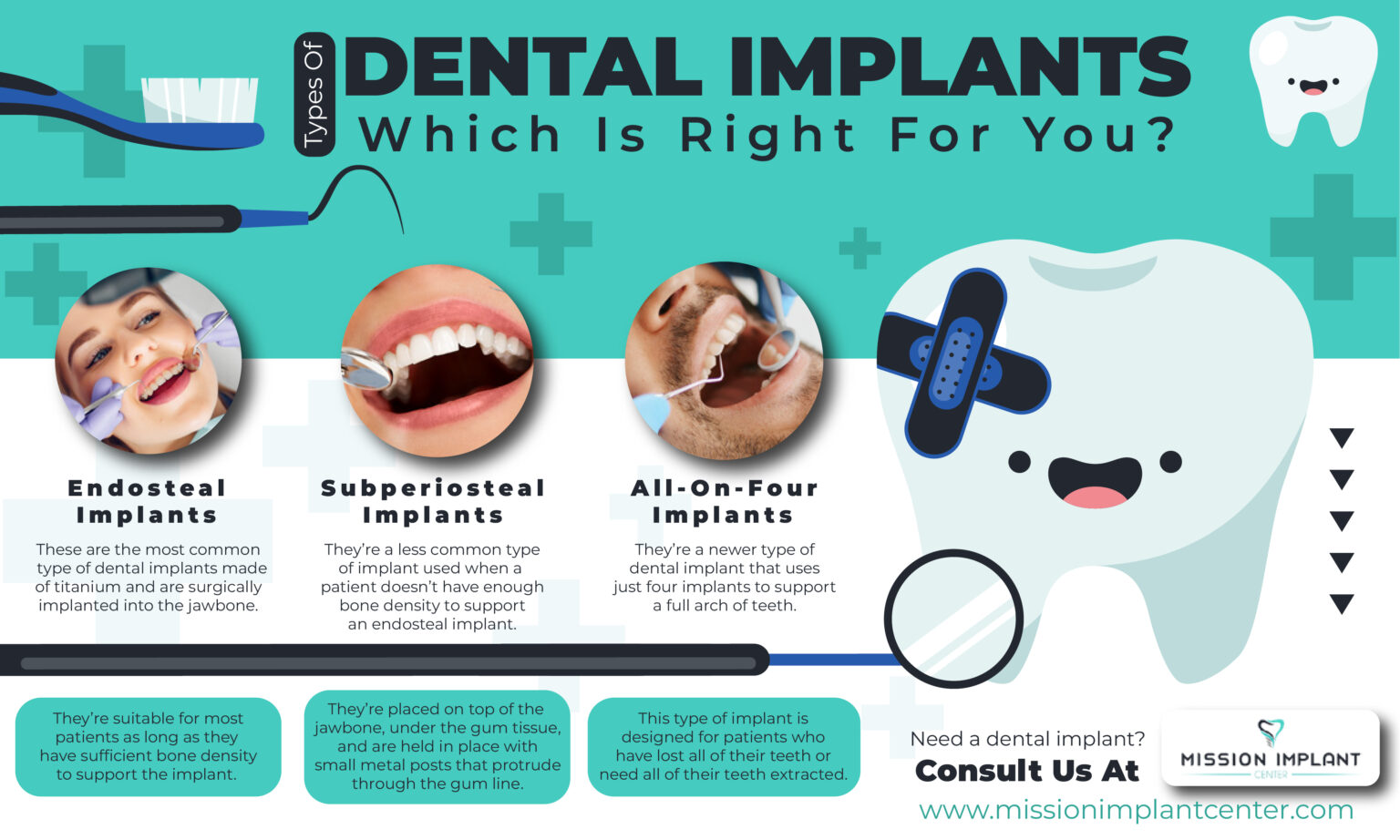 Types Of Dental Implants: Which Is Right For You ? - missionimplantcenter